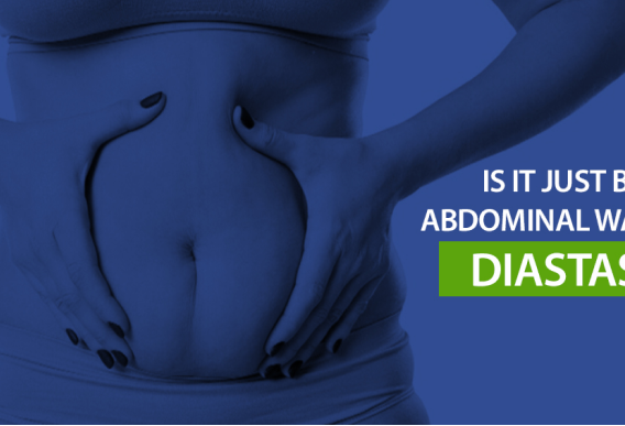 Diastasis Recti : Is it just belly fat or Abdominal Wall Separation